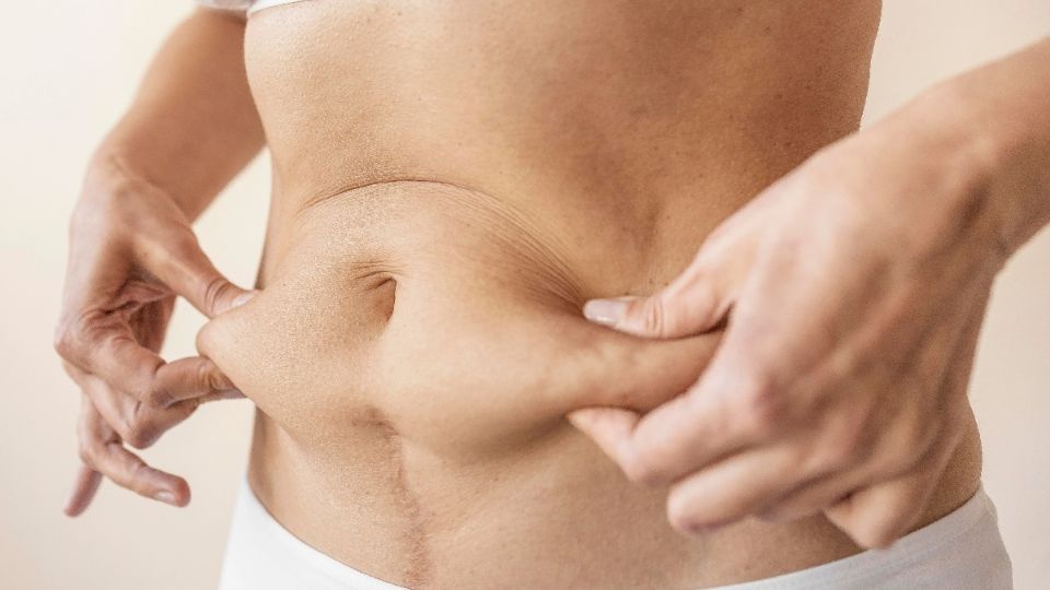 Ejercicios para eliminar la flacidez del abdomen